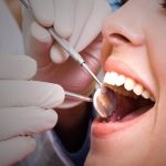Dental Care and Implants
